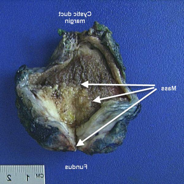Macroscopic image of a organ biopsy